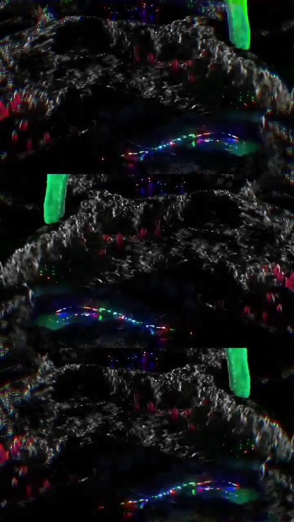 Intergalactic Drip